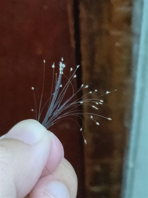 Hair Follicle White Bulb Cell Well Being Hair Bulb Follicle Through