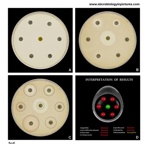 Kirby-Bauer test (method) as an antibiotic susceptibility testing ...