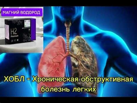 🔥ХОБЛ -Хроническая обструктивная болезнь лёгких .Магний водород Н2 ...