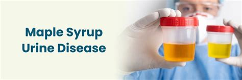 Enfermedad de la orina con olor a jarabe de arce: síntomas, causas y ...