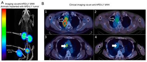 Nanobodies for Medical Imaging: About Ready for Prime Time?