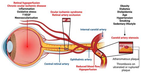 Molecular and Cellular Mechanisms Involved in the Pathophysiology of ...