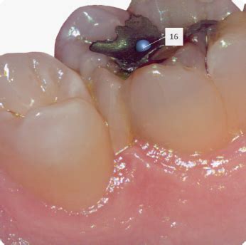 Image result for 3Shape Scan