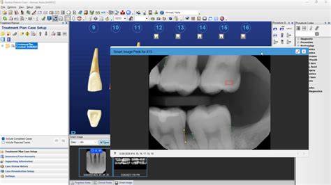 Image result for Dentrix Study Guide