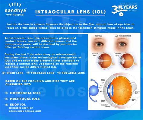Lens Capsule Types at Steve Heffner blog