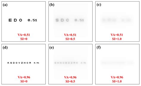 Subjective Straylight Index: A Visual Test for Retinal Contrast ...