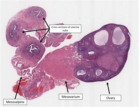 Mesovarium Histology