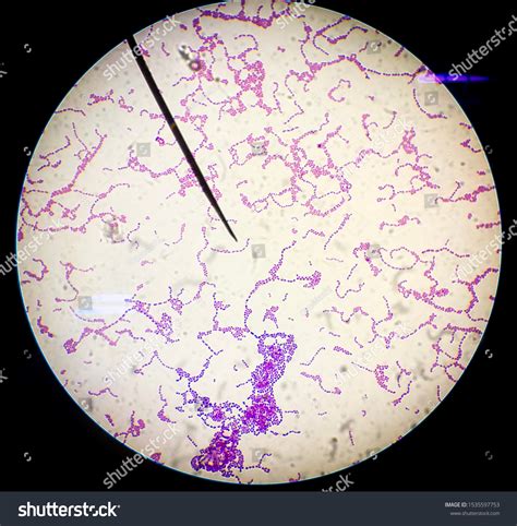 Gram Positive Cocci In Chains Enterococcus Species Archives Medical