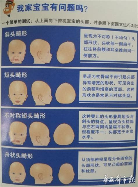 婴幼儿缺乏维生素D有什么症状？如何给宝宝补充维生素D？