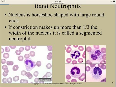 Neutrophilic Band