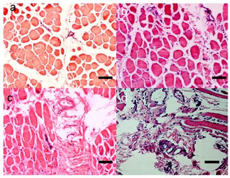 Treatment of Peripheral Artery Disease Using Injectable Biomaterials ...