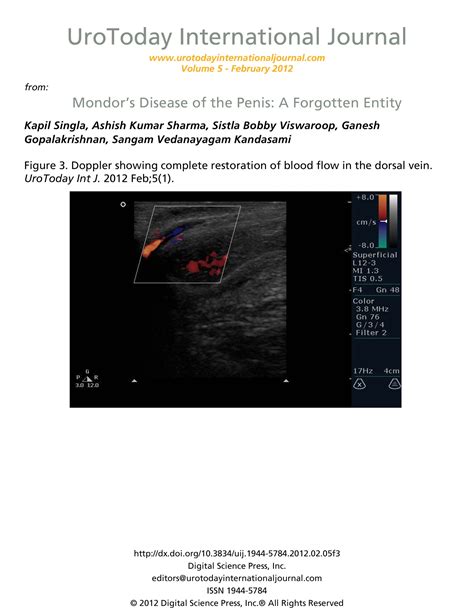 Mondor’s Disease of the Penis: A Forgotten Entity