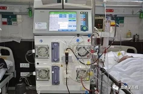 CRRT Recirculation 的图像结果