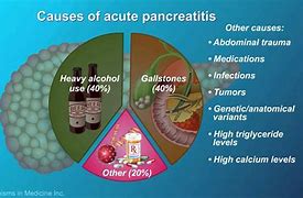 Image result for pancreas pain