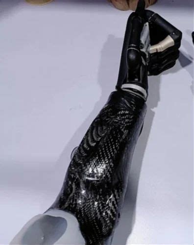 Artificial Limb and Myoelectric Hands - Bionic Artificial Hand ...