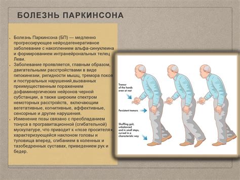 Болезнь паркинсона синдром паркинсона: Болезнь Паркинсона – причины ...