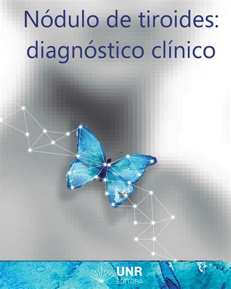 Nódulo de Tiroides: diagnóstico clínico • Editora UNR