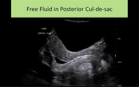 Ultrasound Registry Review - General Information