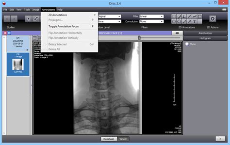 25 Free & open source DICOM Viewers for Windows