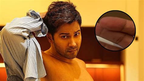 'How Long Does It Take To Heal?': Varun Dhawan Gets Injured During A ...