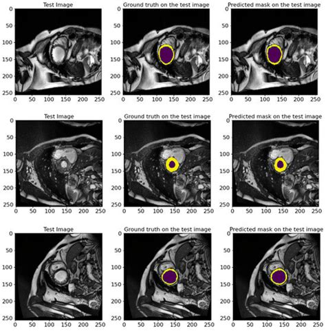 ResST-SEUNet++: Deep Model for Accurate Segmentation of Left Ventricle ...