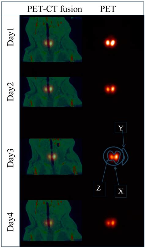 The Combination of In vivo 124I-PET and CT Small Animal Imaging for ...