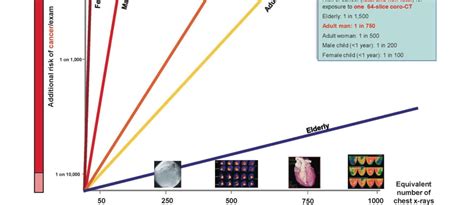 CT Scan Radiation 的图像结果