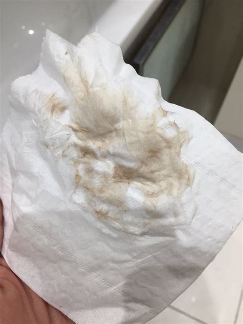 Is this implantation bleeding? - Page: 2