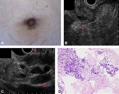 Sister Mary Joseph Sign
