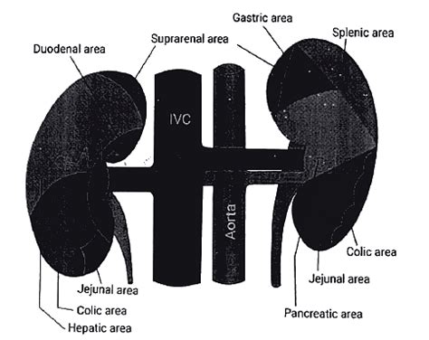 Kidney: Clinical Anatomy - Medical Science Optional Notes for UPSC PDF ...