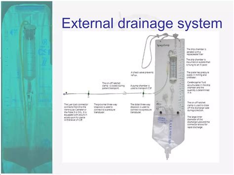 External Ventricular Drain | PPT