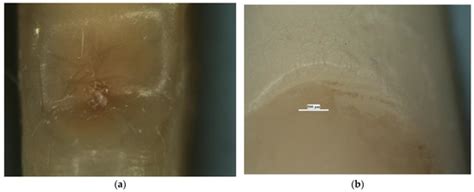 Diagnostics | Special Issue : Advances in Dental Imaging