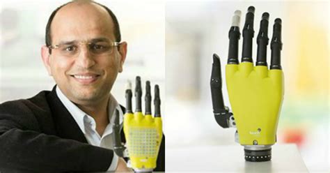Indian Researcher Makes Touch Sensitive Prosthetic Arm That Could Give ...