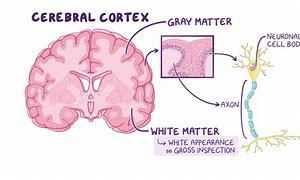 white matter 的图像结果