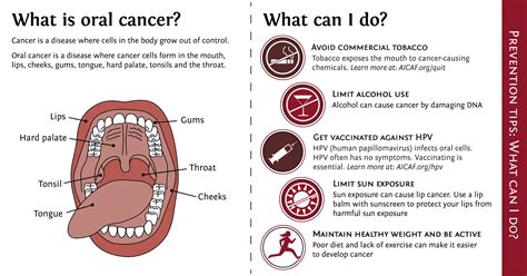 Early Mouth Cancer Symptoms