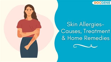 Skin Allergies - Causes, Treatment & Home Remedies