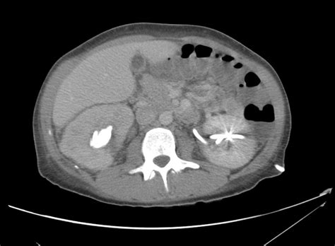 Pyel O Medical Term Deep Dive - Protectlab