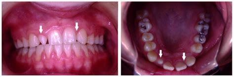 Children | March 2023 - Browse Articles