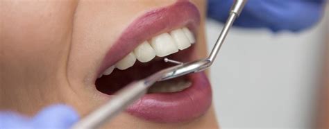 Tooth Extraction 的图像结果