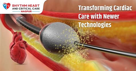 How an Ambient Cardiology Scribe Restores the Rhythm of Care
