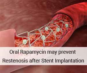 Oral Rapamycin may prevent restenosis after Coronary bare metal Stent ...
