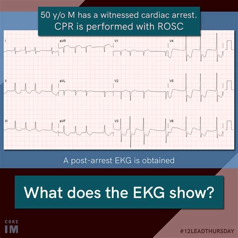 50M has a witnessed cardiac arrest | Core IM Podcast