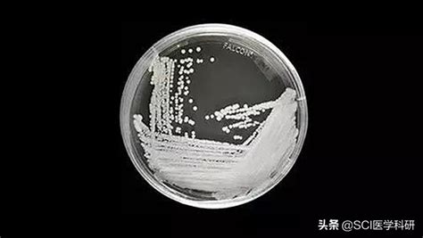 美國爆耳念珠菌感染「1／3病患90天死亡」 台灣曾出現3例…3種人最危險 | 生活 | CTWANT