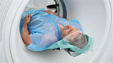 Lung Cancer Cat Scan