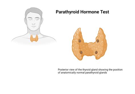 Parathyroid Hormone (PTH) Lab Assessment - My Endo Consult
