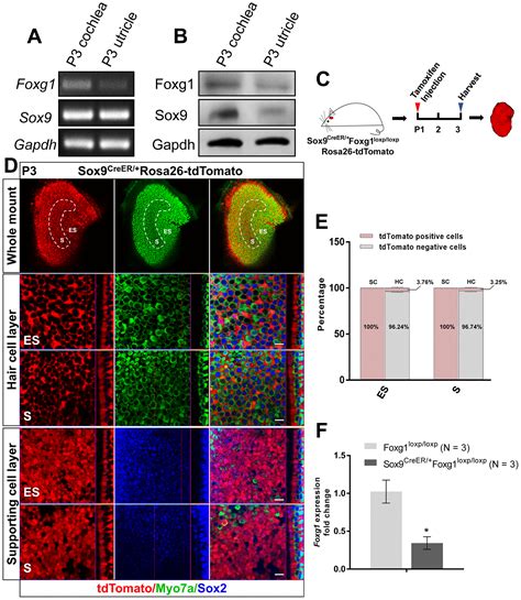 Knockdown of Foxg1 in Sox9+ supporting cells increases the trans-differentiation of supporting ...