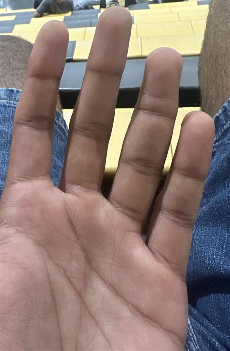 Image result for Left Hand Ring Finger