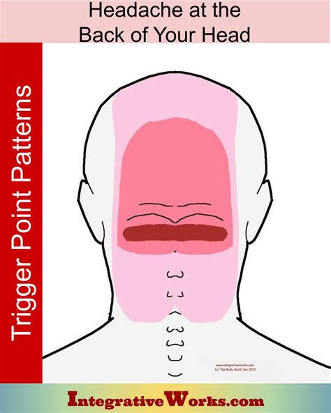 Headache at the base of your head - Integrative Works