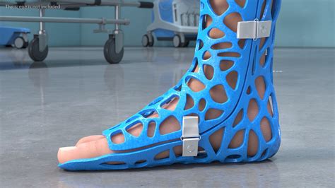 3D-Printed Orthopedic Casts On Limbs Collection 3D - TurboSquid 1920148
