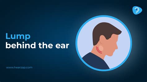 Lumps & Bumps Behind Your Ears? Here’s What You Need to Do